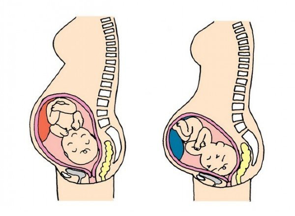 出産時の痛み画像